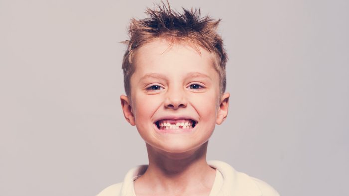 Young boy with missing teeth grandville pediatric dentists mi
